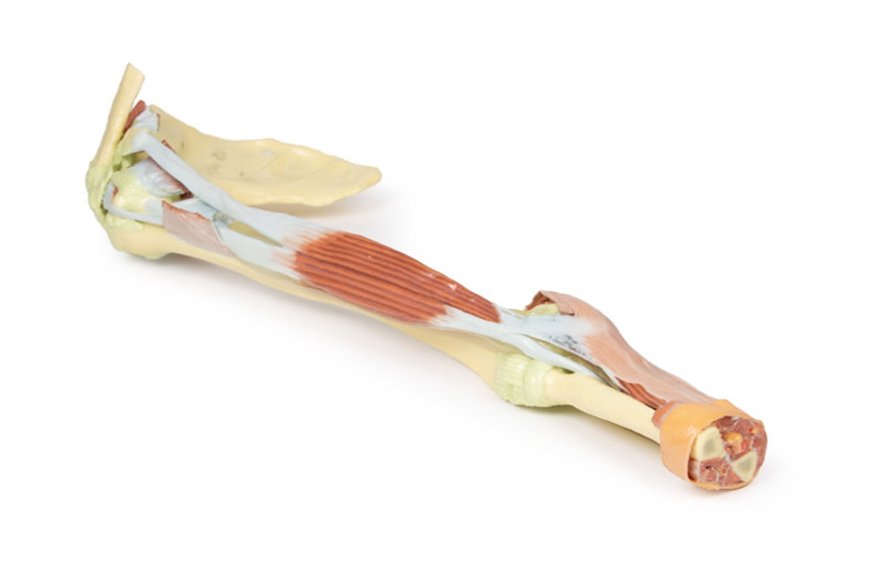 3D Printed Upper Limb - Biceps, Bones and Ligaments