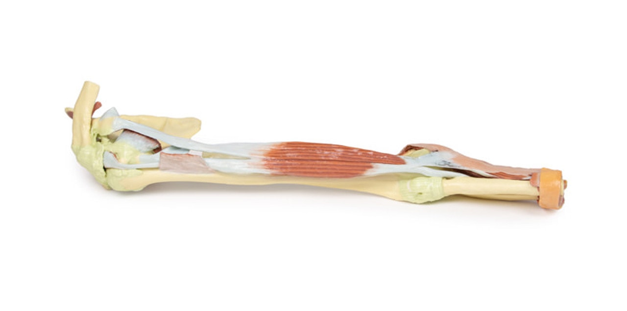 3D Printed Upper Limb - Biceps, Bones and Ligaments