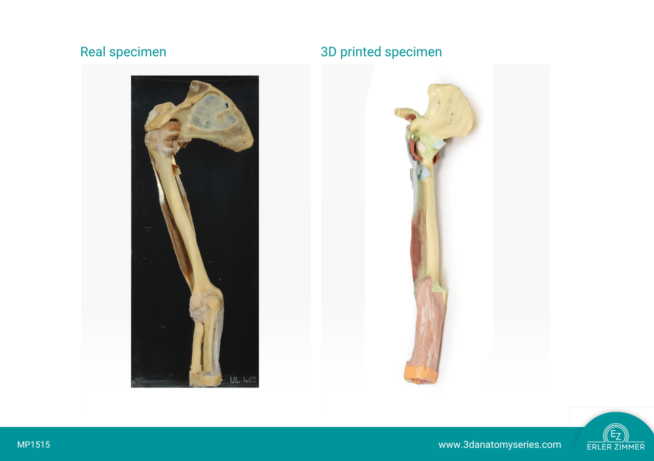 3D Printed Upper Limb - Biceps, Bones and Ligaments