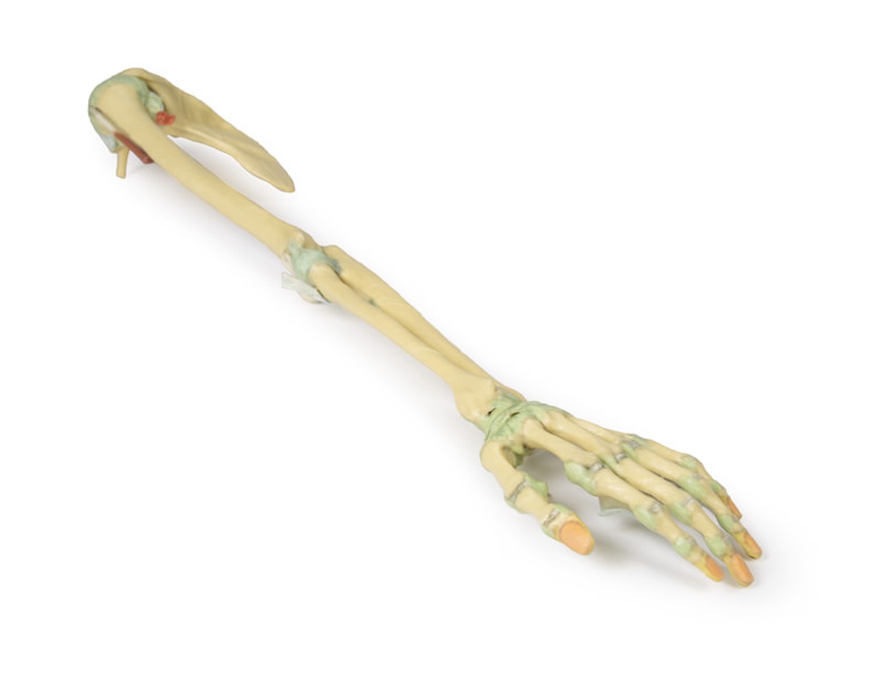 3D Printed Upper Limb - Ligaments