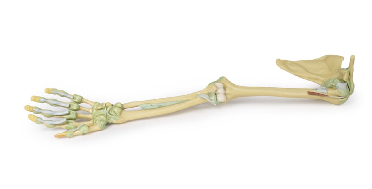 3D Printed Upper Limb - Ligaments