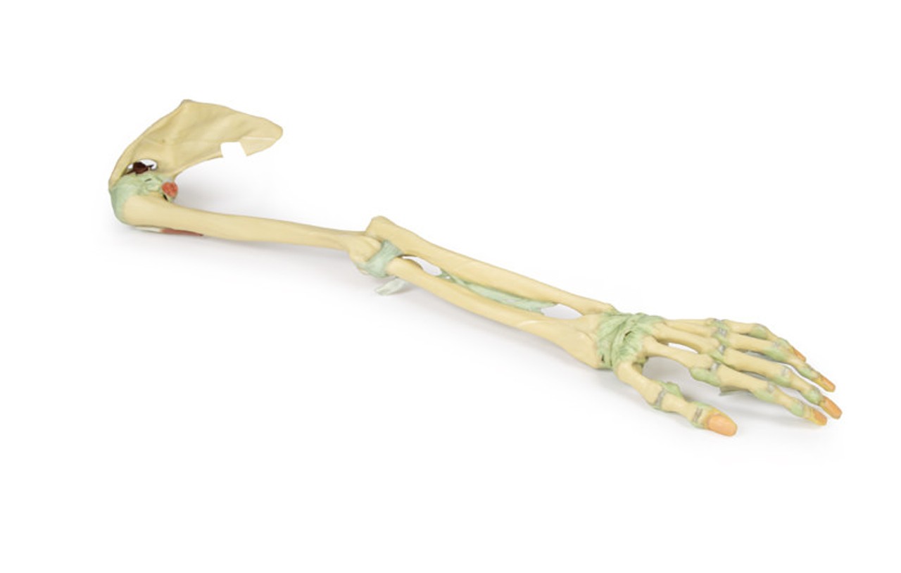 3D Printed Upper Limb - Ligaments