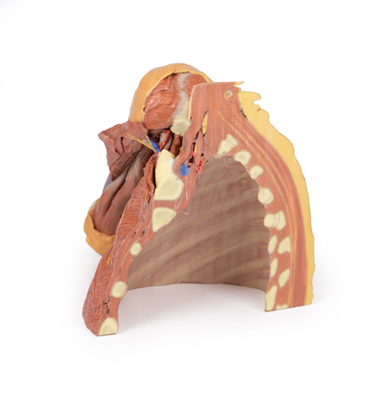 3D Printed Right Thoracic Wall, Axilla, and the Root of the Neck