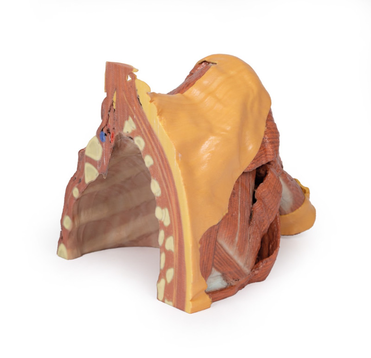 3D Printed Right Thoracic Wall, Axilla, and the Root of the Neck