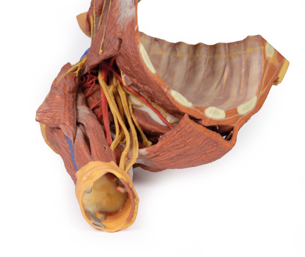 3D Printed Right Thoracic Wall, Axilla, and the Root of the Neck