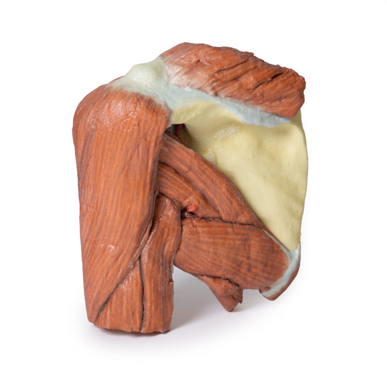 3D Printed Shoulder (left) Superficial Muscles and Axillary/Brachial Artery