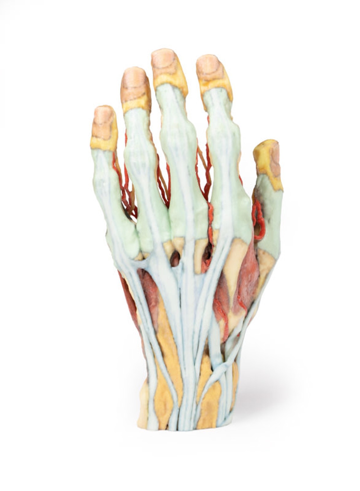 3D Printed Superficial Dissection of the Hand
