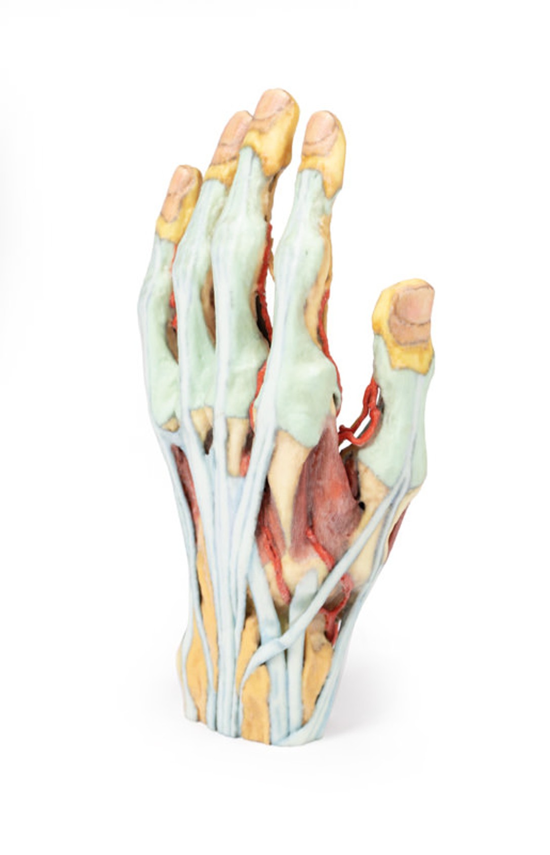 3D Printed Superficial Dissection of the Hand