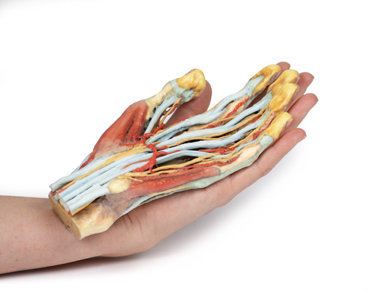 3D Printed Superficial Dissection of the Hand