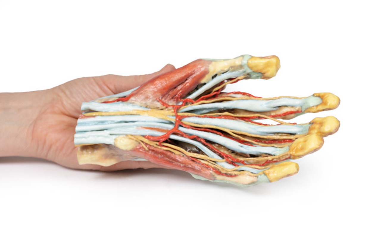 3D Printed Superficial Dissection of the Hand