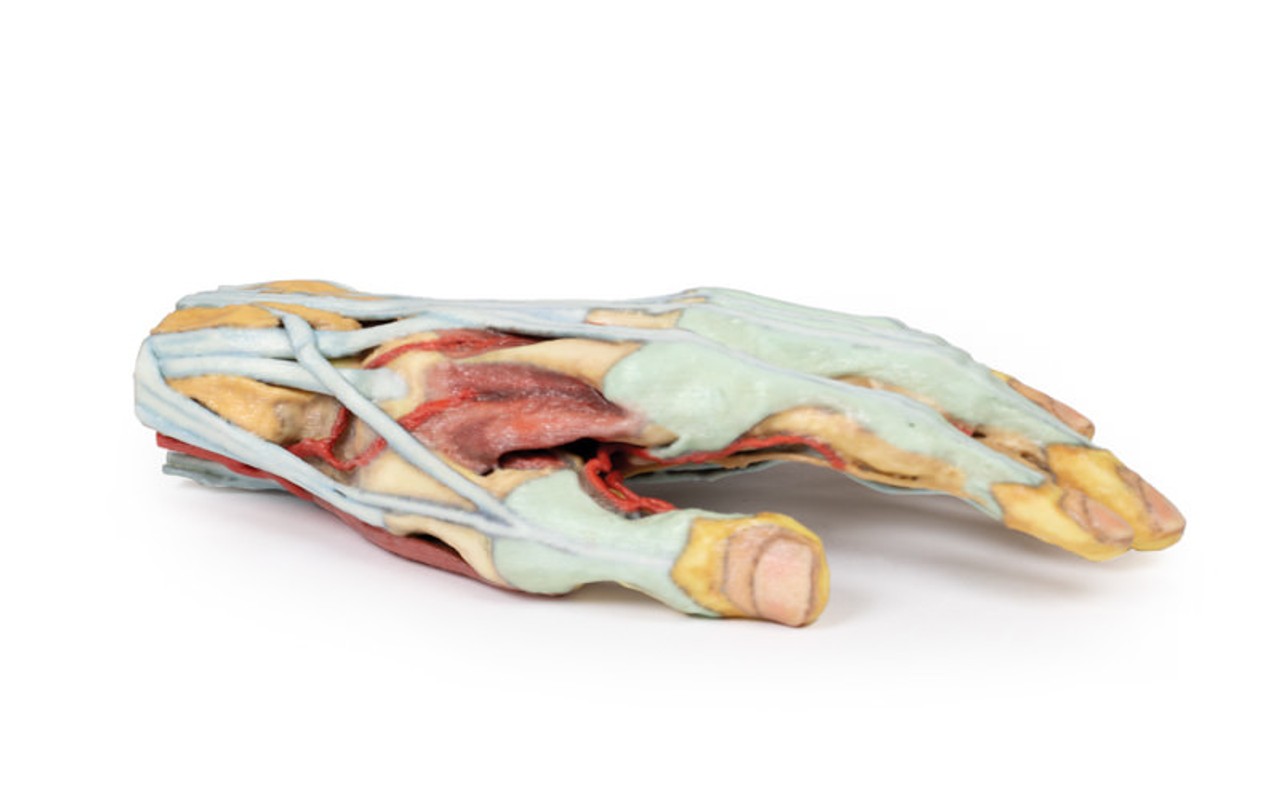 3D Printed Superficial Dissection of the Hand