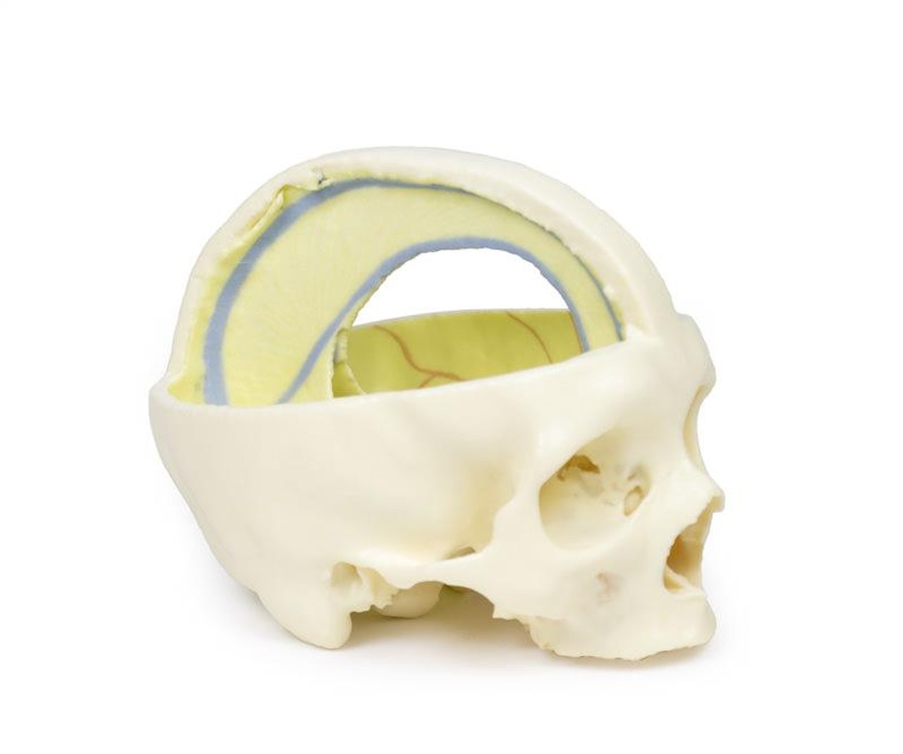 3D printed dural skull. Full view. Exposed cranial cavity. Side angle.