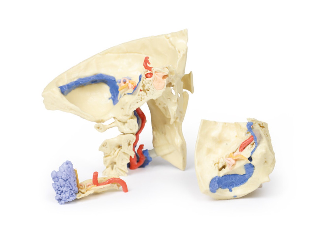 3D Printed Temporal Bone Model, Set of 3