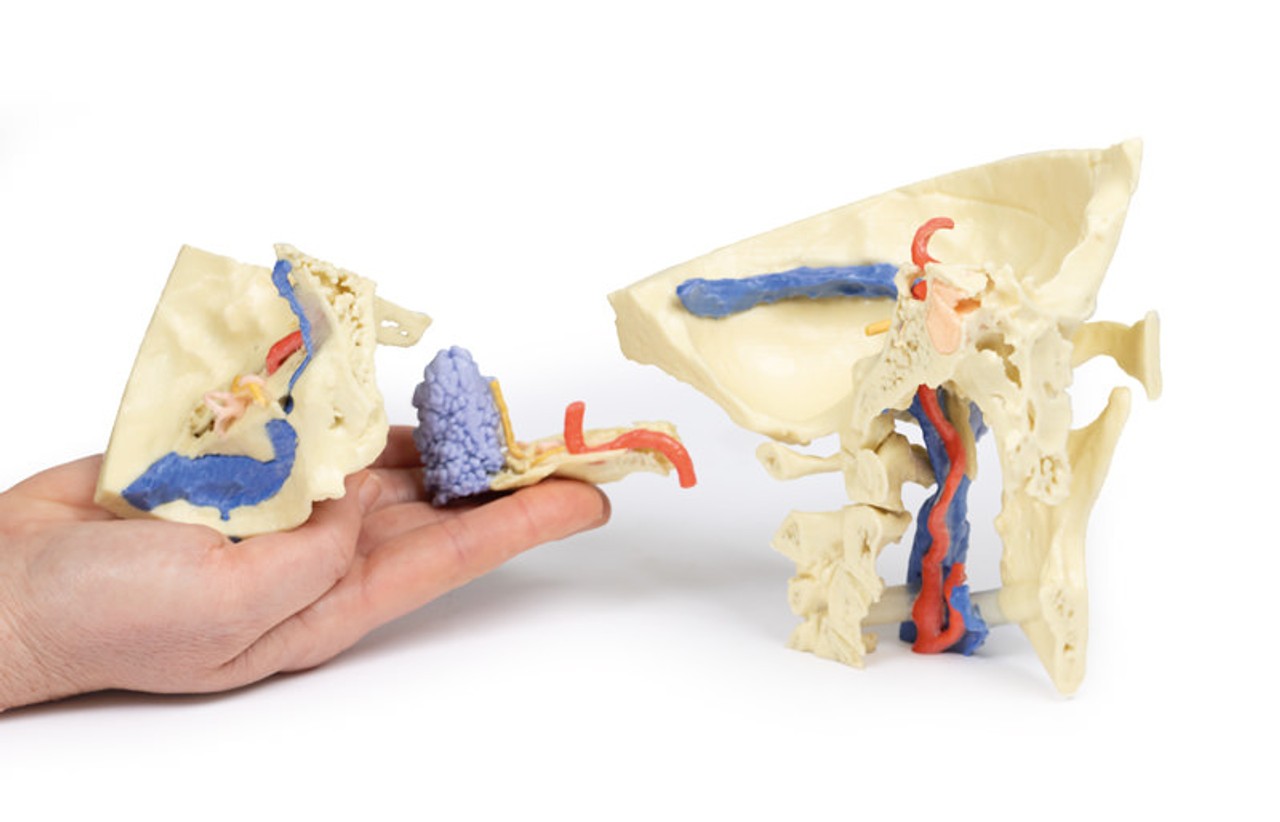 3D Printed Temporal Bone Model, Set of 3