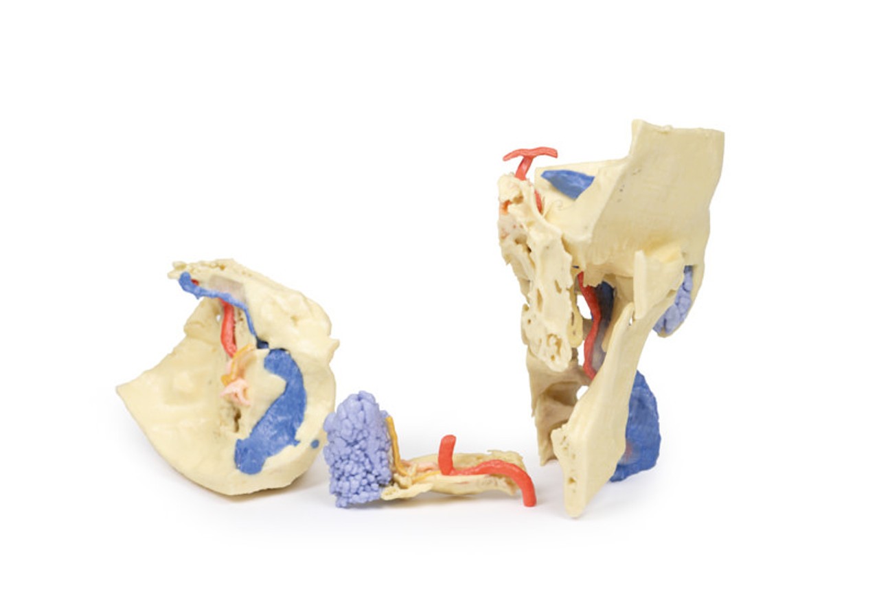 3D Printed Temporal Bone Model, Set of 3