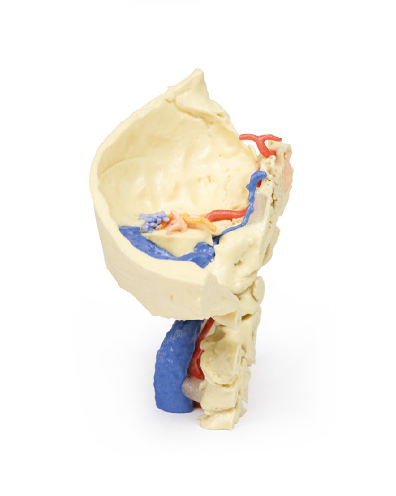 3D Printed Temporal Bone Model, Set of 3