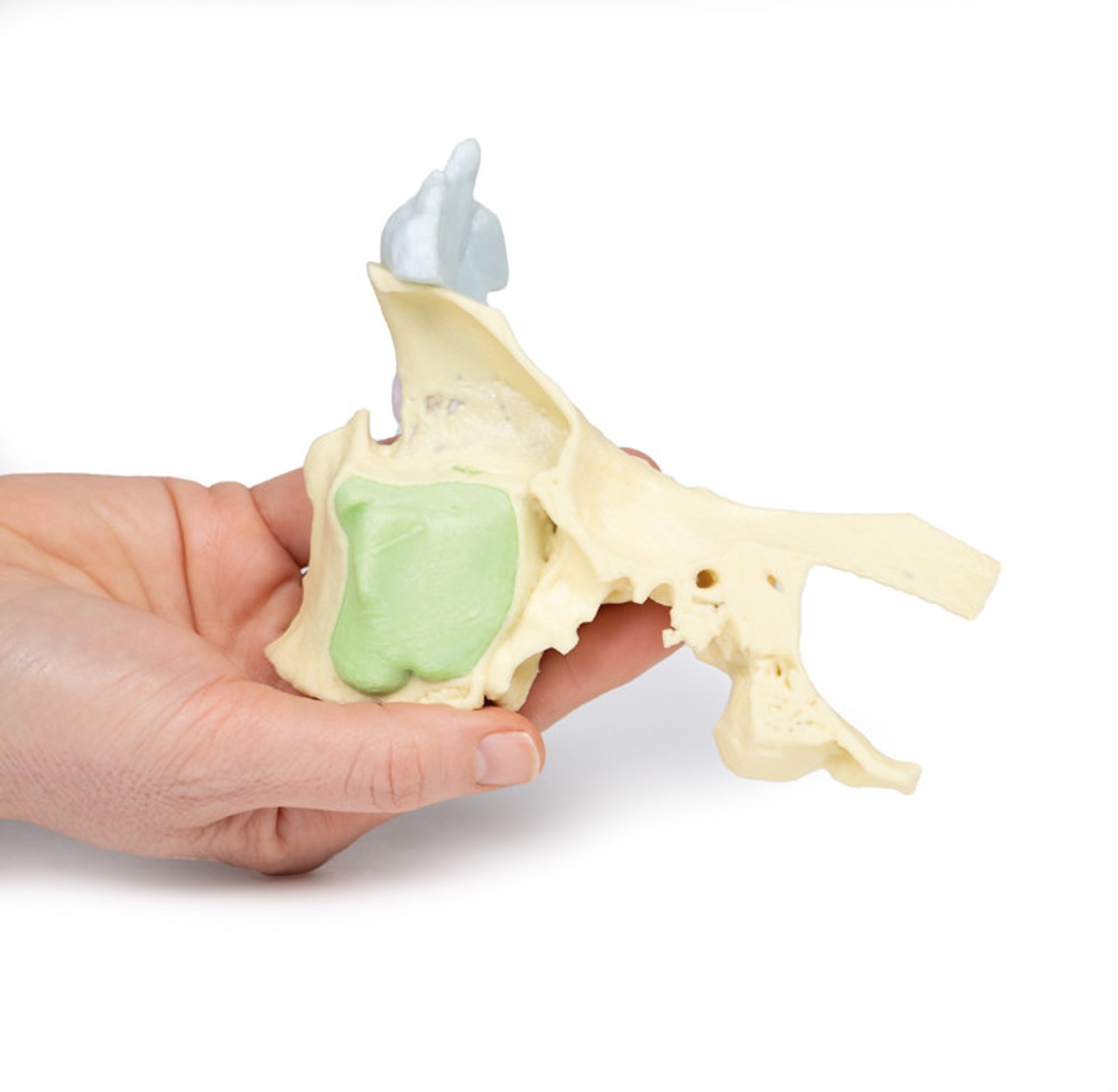 3D Printed Paranasal Sinus Model