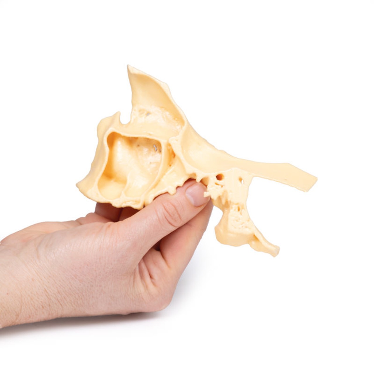 3D Printed Paranasal Sinus Model