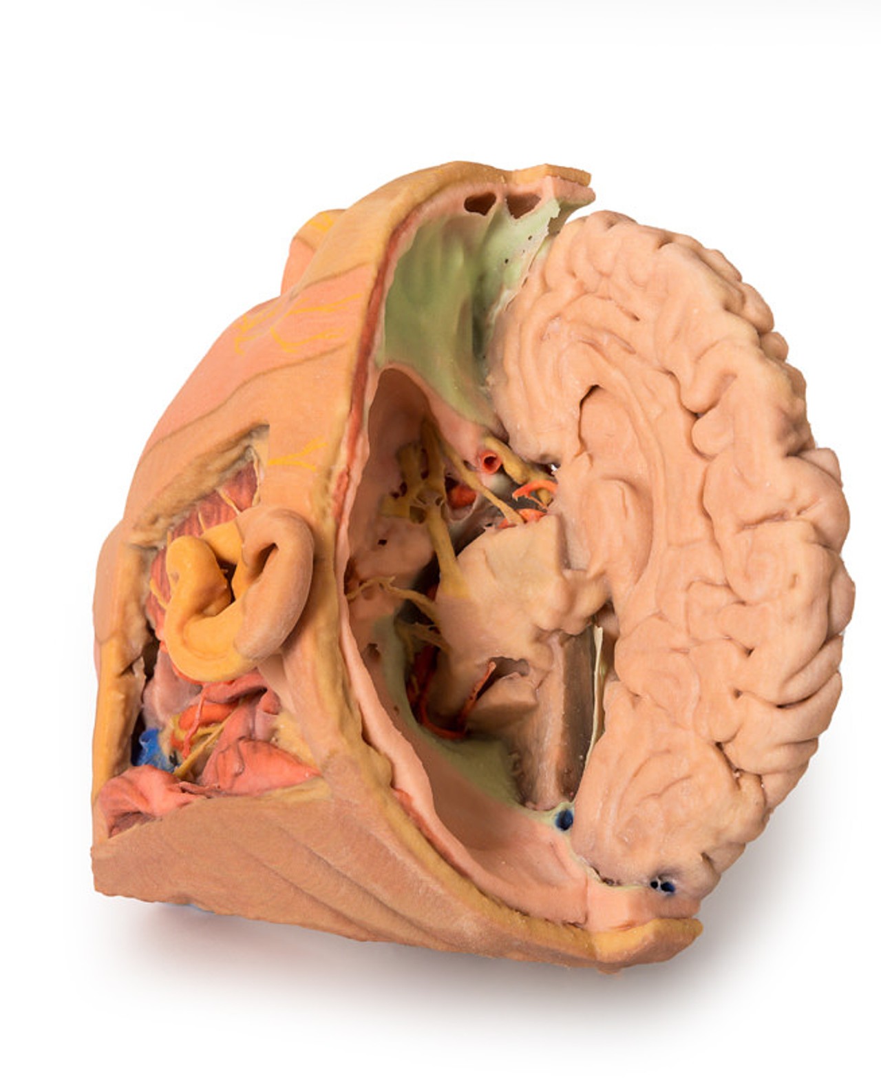3D Printed Parasagittally - Sectioned Head and Neck