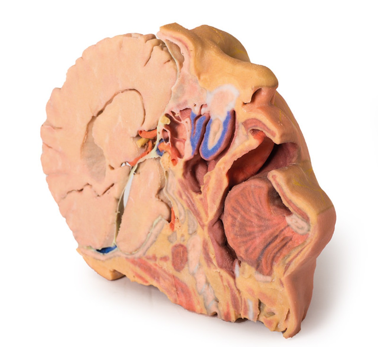 3D Printed Parasagittally - Sectioned Head and Neck
