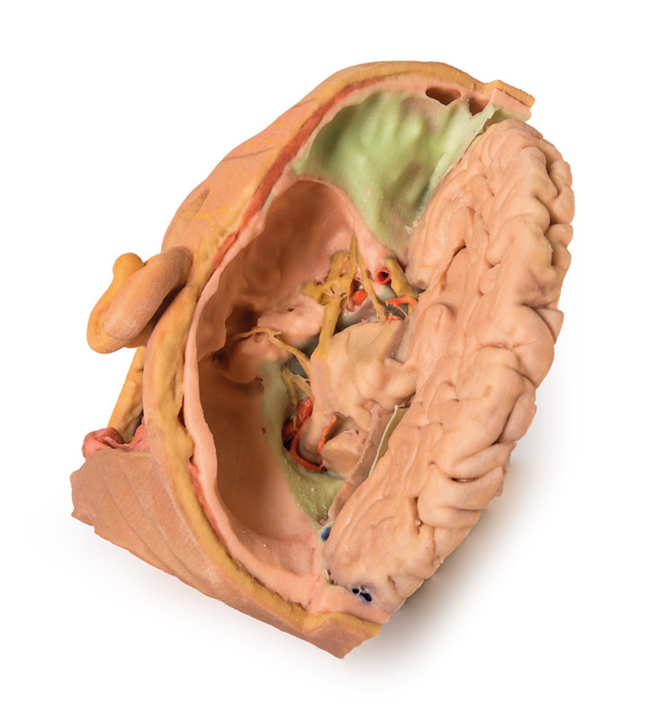 3D Printed Parasagittally - Sectioned Head and Neck