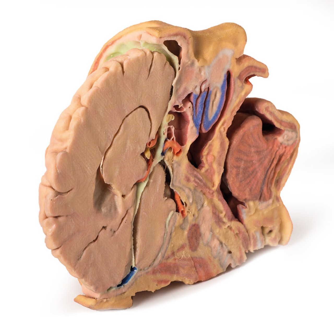 3D Printed Parasagittally - Sectioned Head and Neck