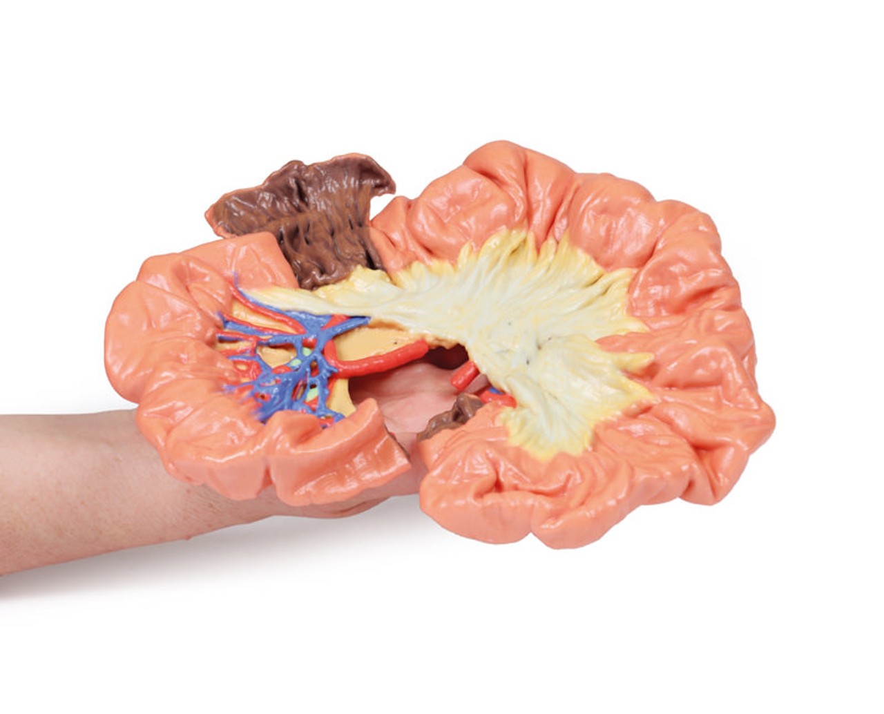 3D printed portion of ileum