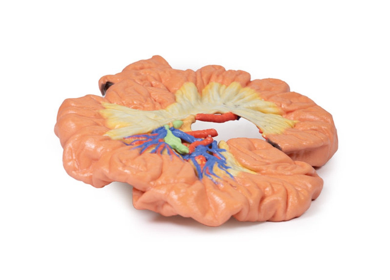 3D printed portion of ileum
