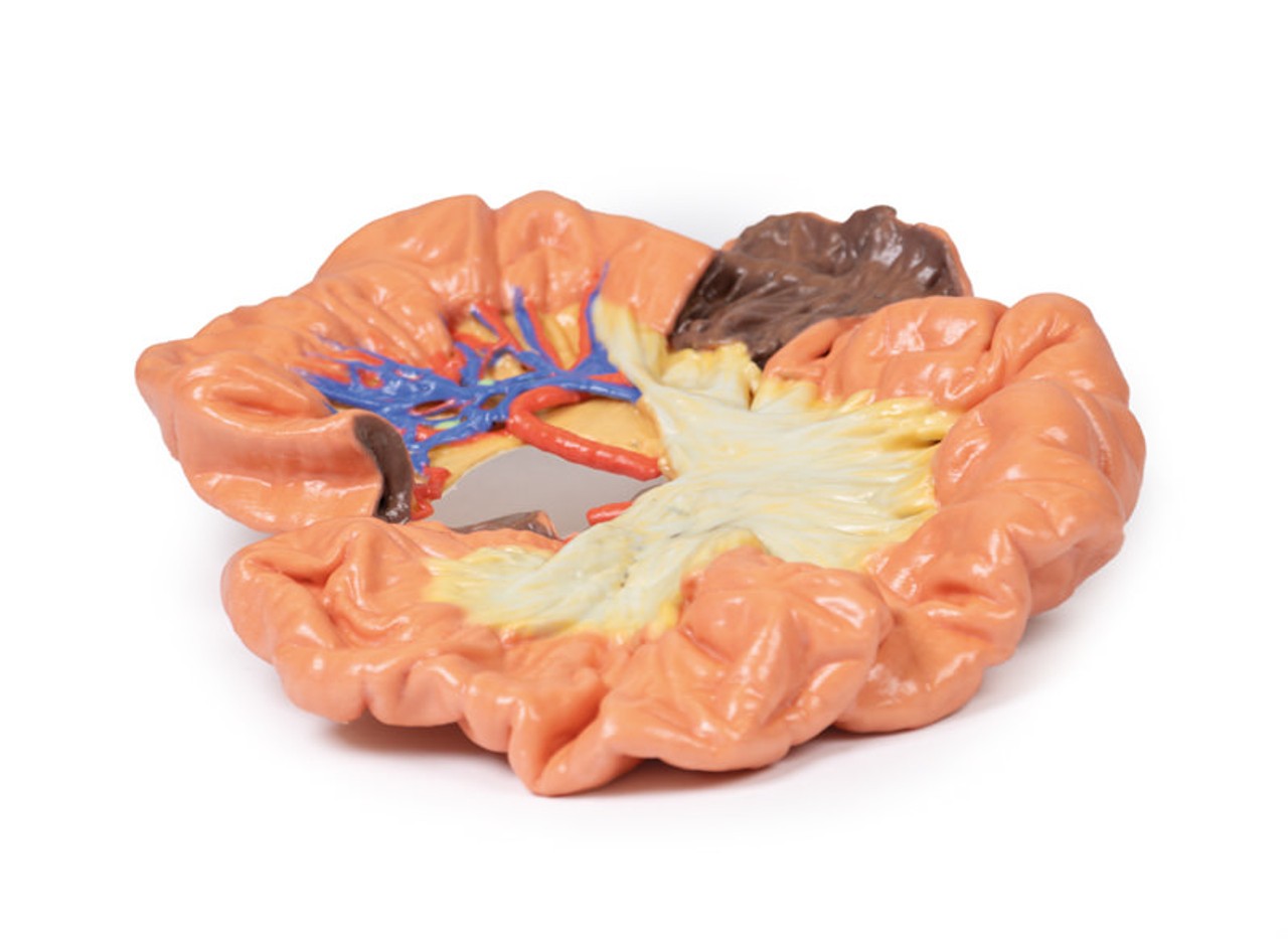 3D printed portion of ileum