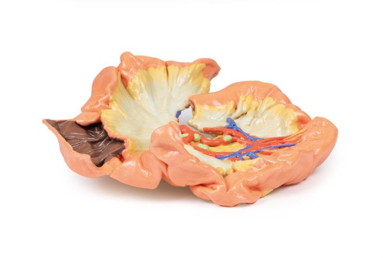 3D printed portion of jejenum. Full view. Exposed arteries.