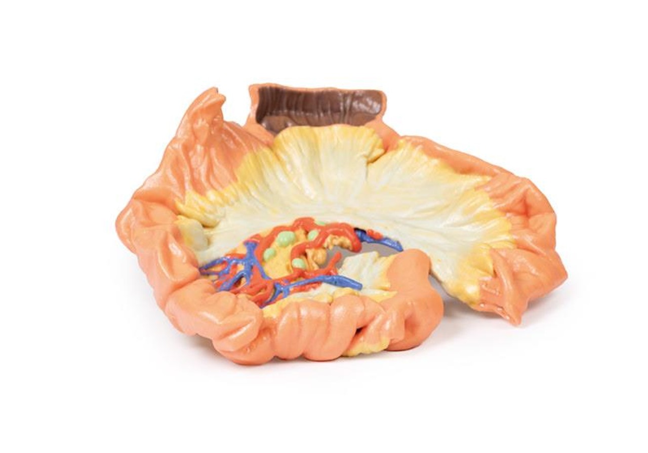 3D printed portion of jejenum. Full view. Exposed arteries.