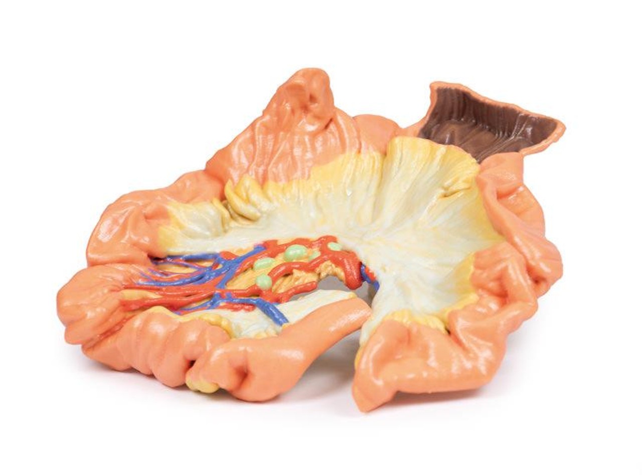 3D printed portion of jejenum. Full view. Exposed arteries.