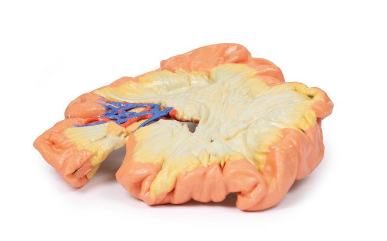 3D printed portion of jejenum. Full view. Exposed arteries. Bottom angle.