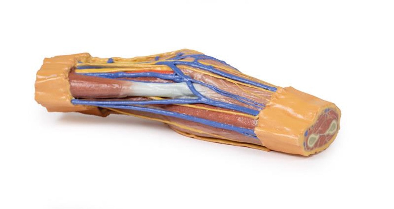 3D printed cubital fossa. Full view. Exposed veins and nerves.