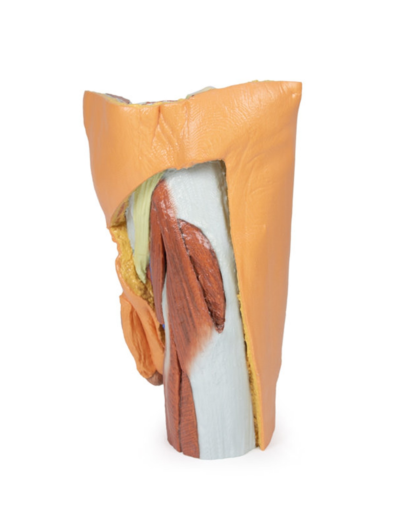 Erler-Zimmer 3D Printed Male Left Pelvis and Proximal Thigh