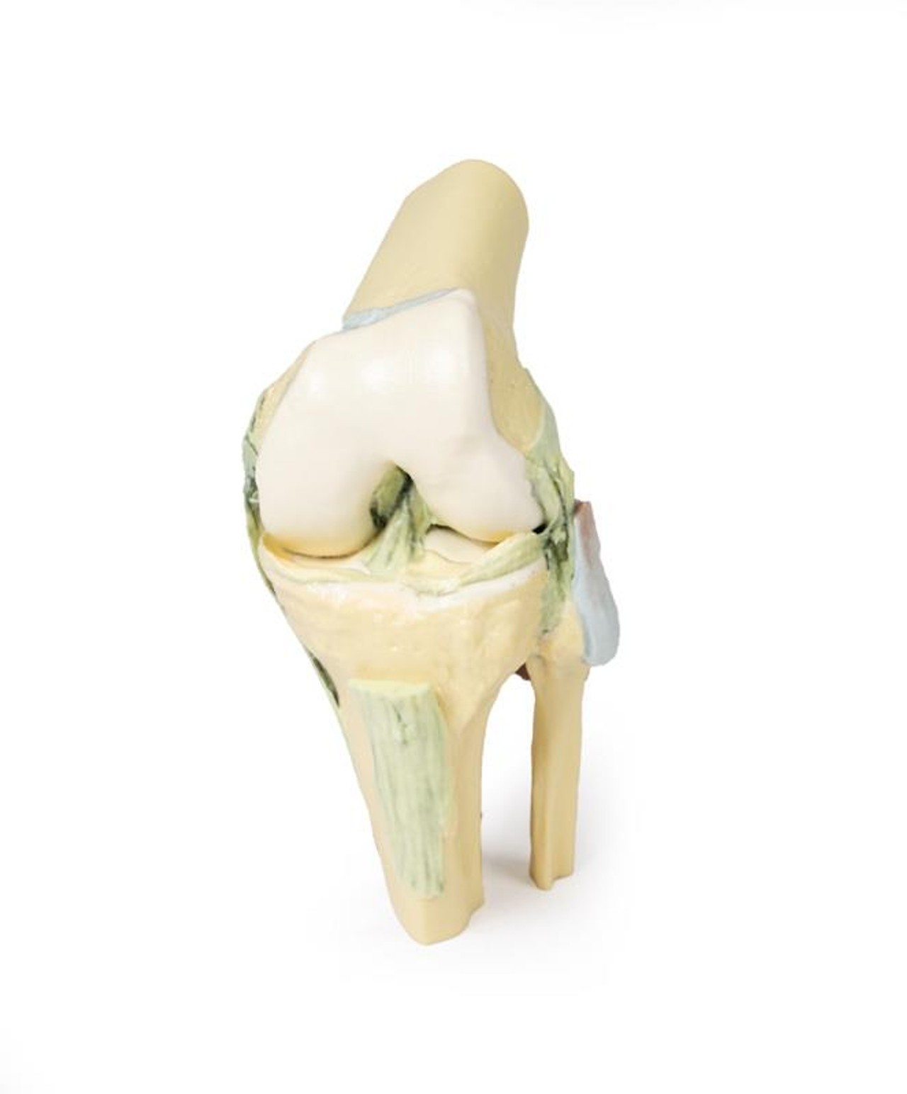 3D printed knee joint. Full view. No skin. Exposed ligaments. Bent.