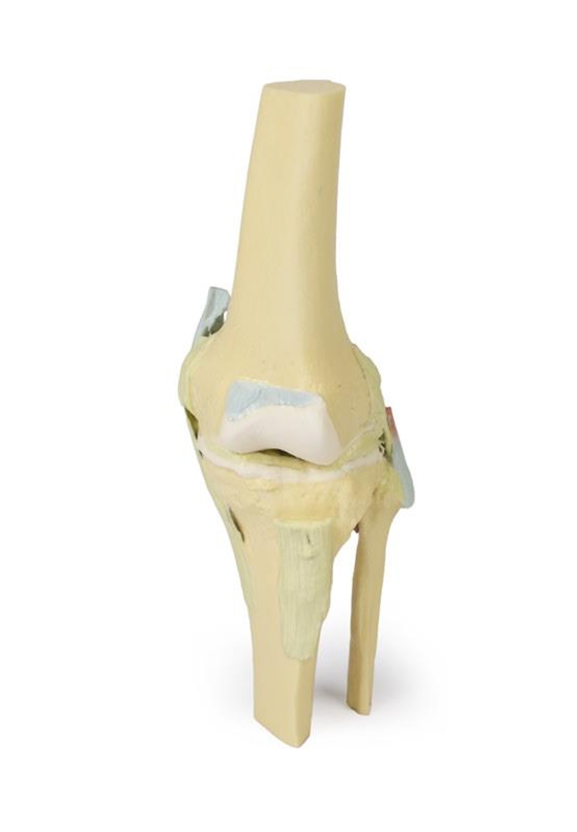 3D printed knee joint. Full view. No skin. Exposed ligaments. Front angle.