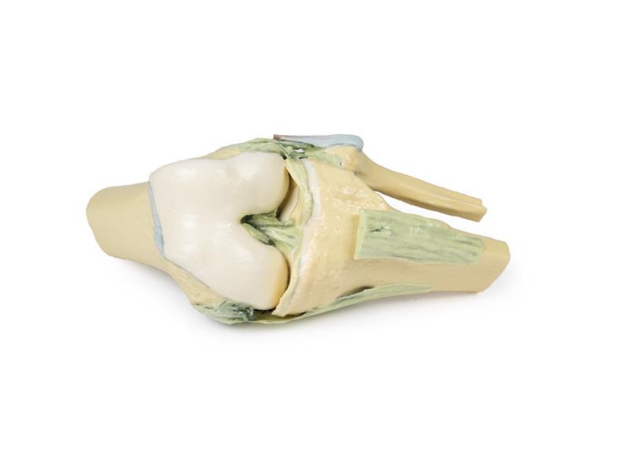 3D printed knee joint. No skin. Exposed ligaments. Bent. Close up.