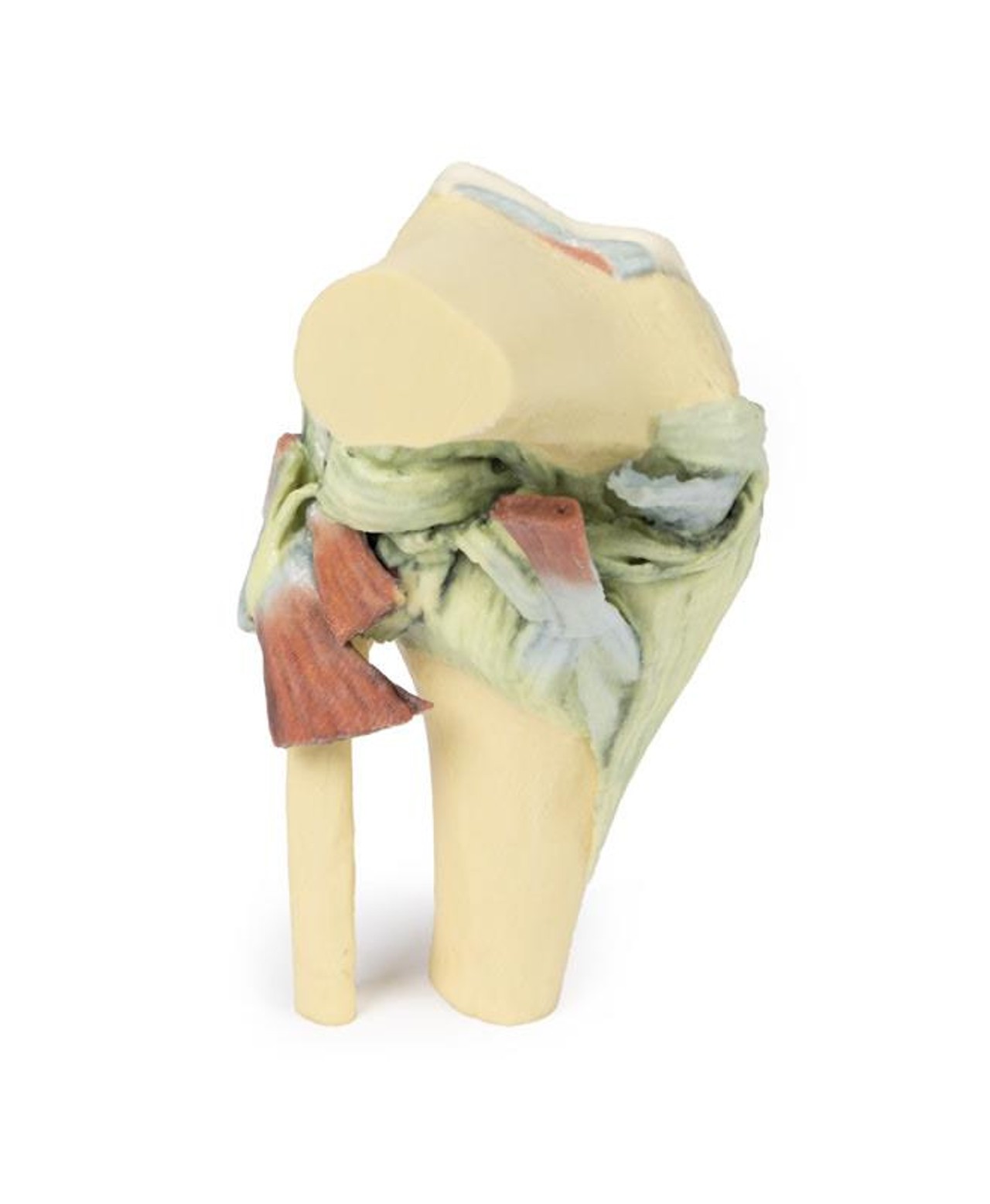 3D printed knee joint. No skin. Exposed ligaments. Close up.