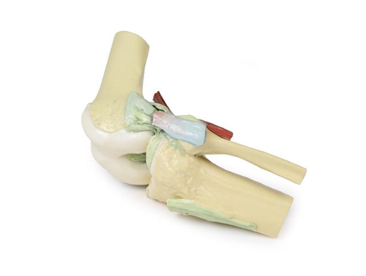 3D printed knee joint. Full view. No skin. Exposed ligaments. Side angle.