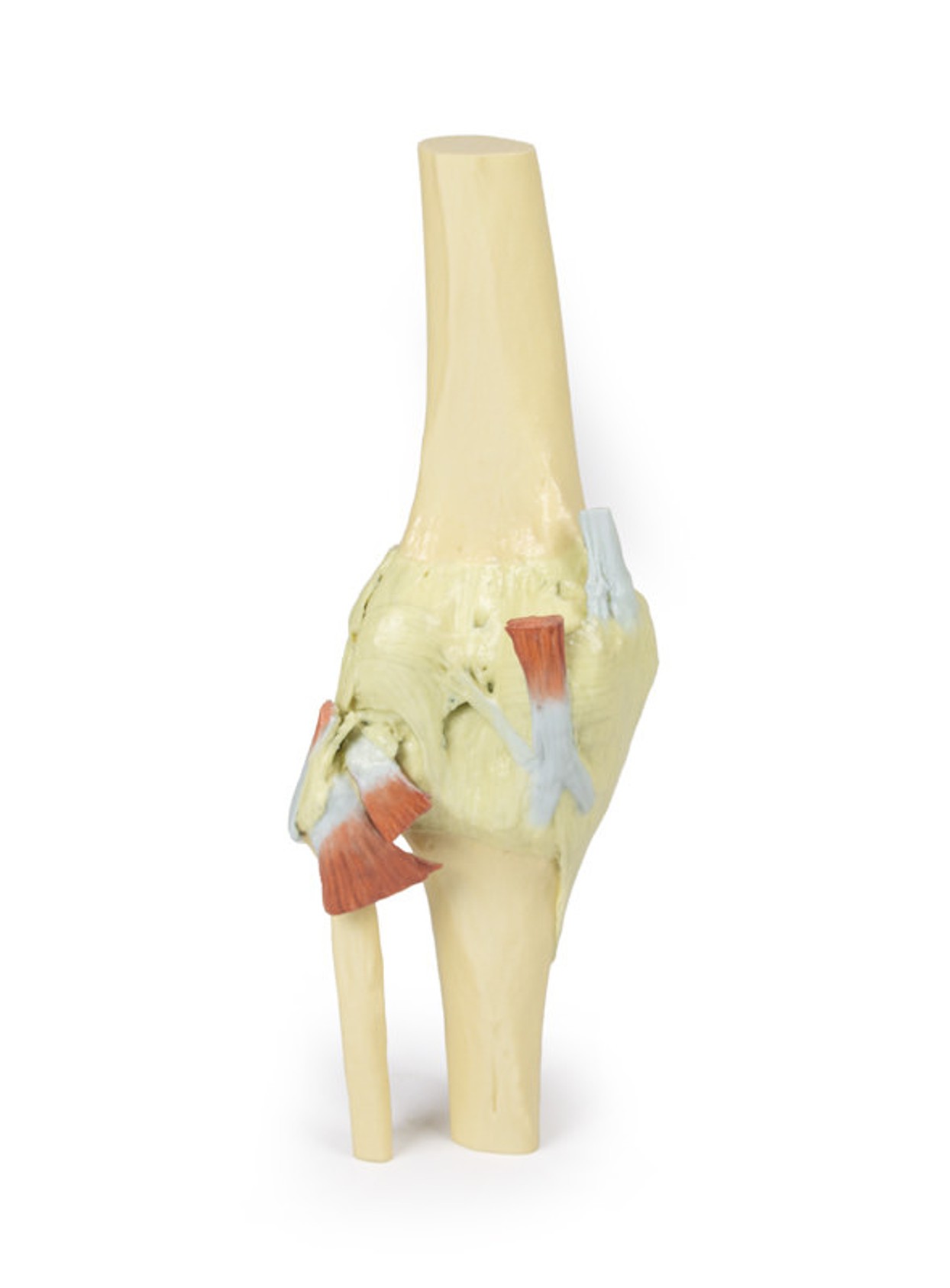 3D printed knee joint. Full view. No skin. Exposed ligaments. Back angle.