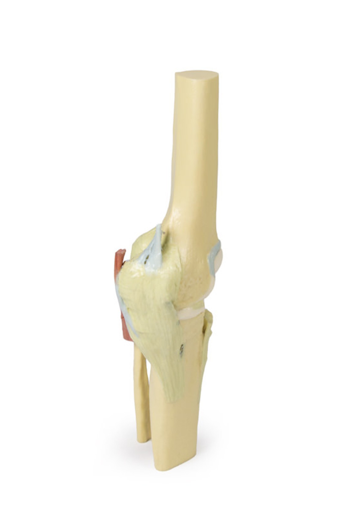 3D printed knee joint. Full view. No skin. Exposed ligaments. Side angle.