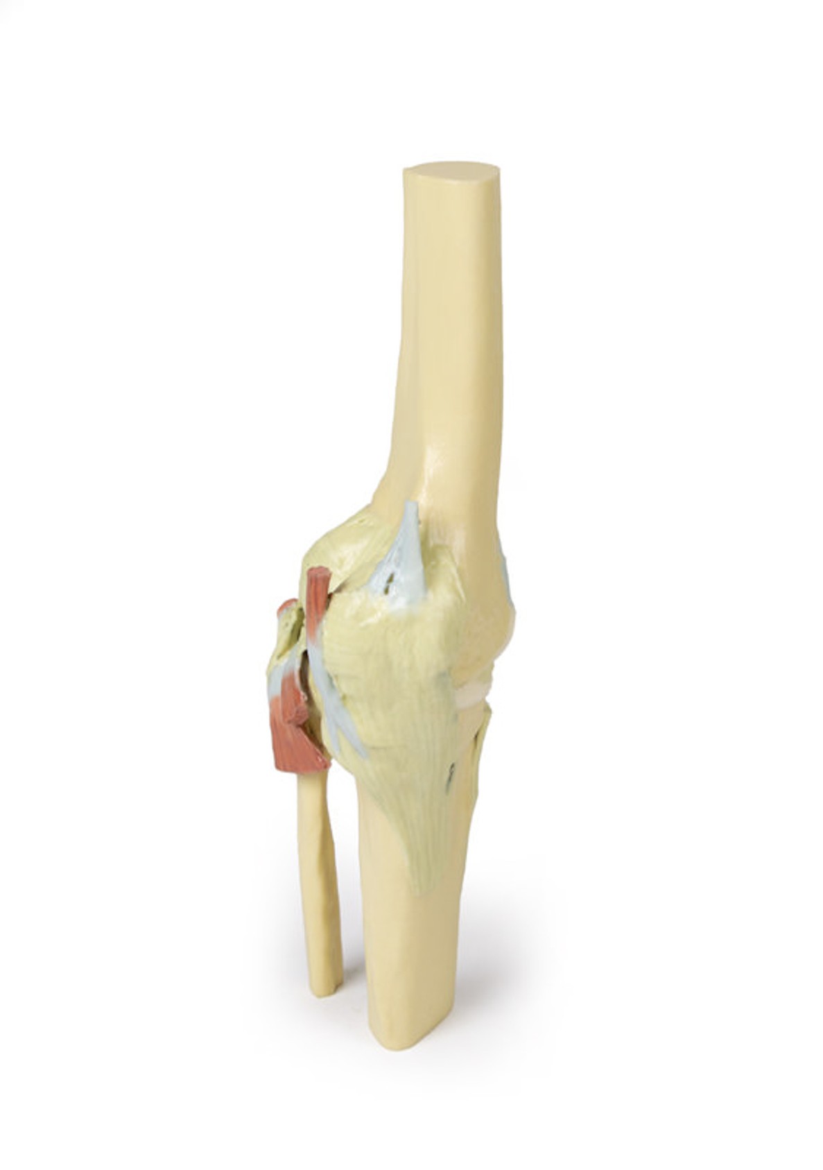 3D printed knee joint. Full view. No skin. Exposed ligaments. Side angle.
