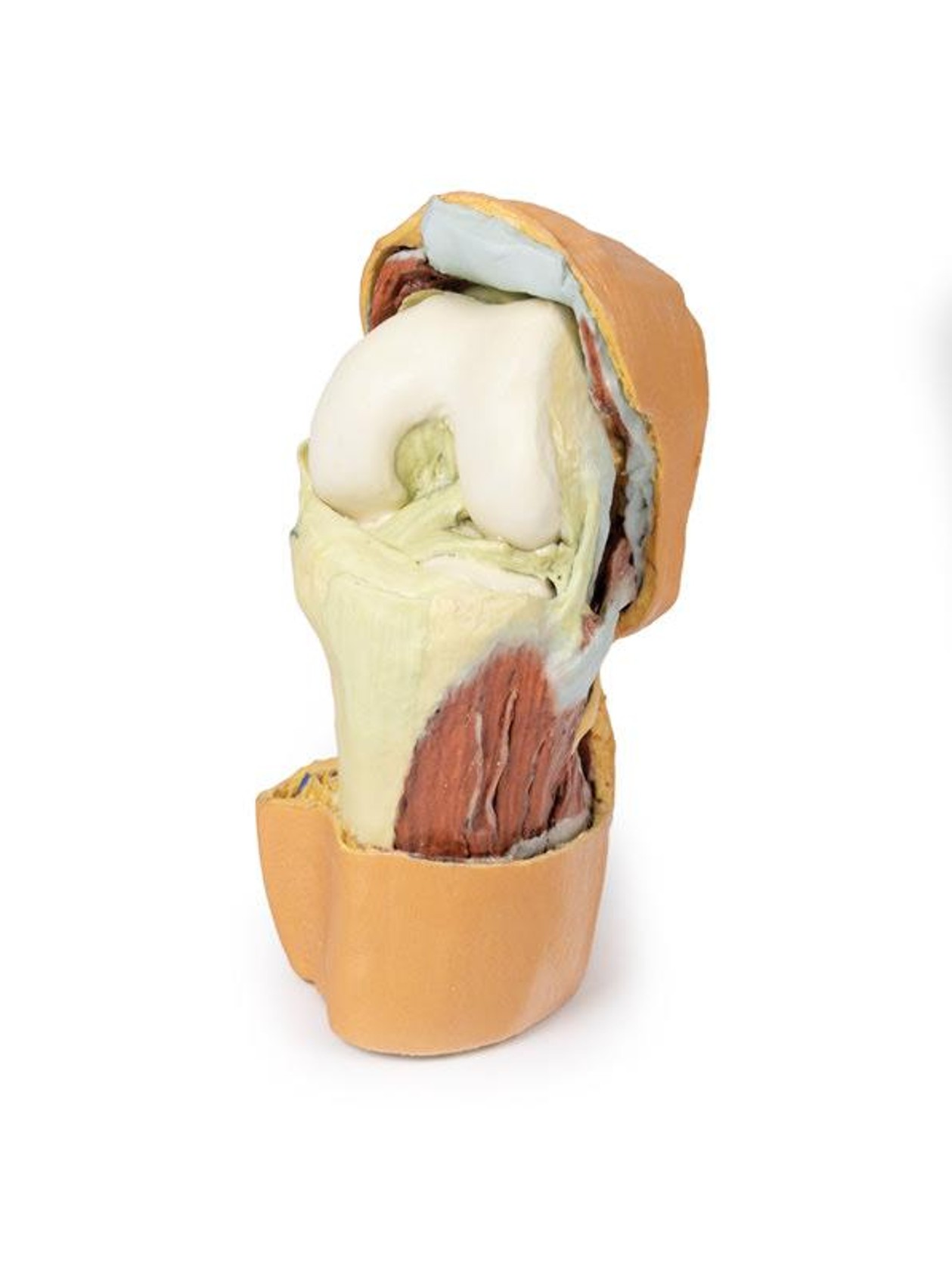 3D printed knee joint. Full view. Exposed bones, muscle, and ligaments. Front angle.