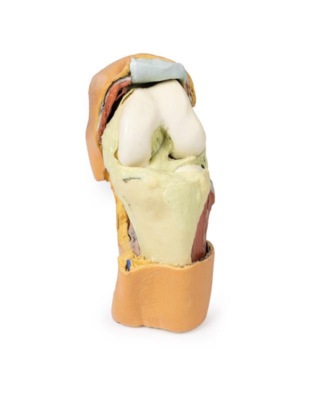 3D printed knee joint. Full view. Exposed bones, muscle, and ligaments. Front angle.