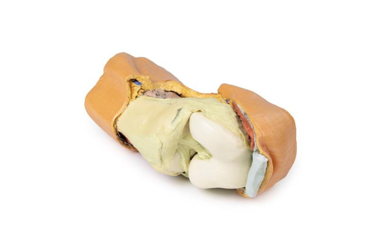 3D printed knee joint. Full view. Exposed bones, muscle, and ligaments.