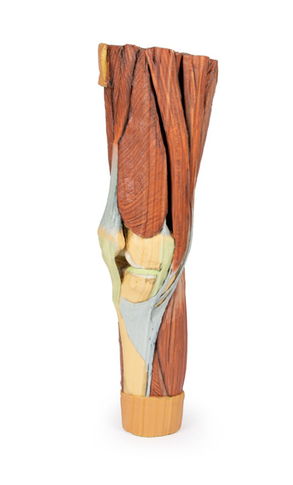 3D Printed Lower Limb Musculature