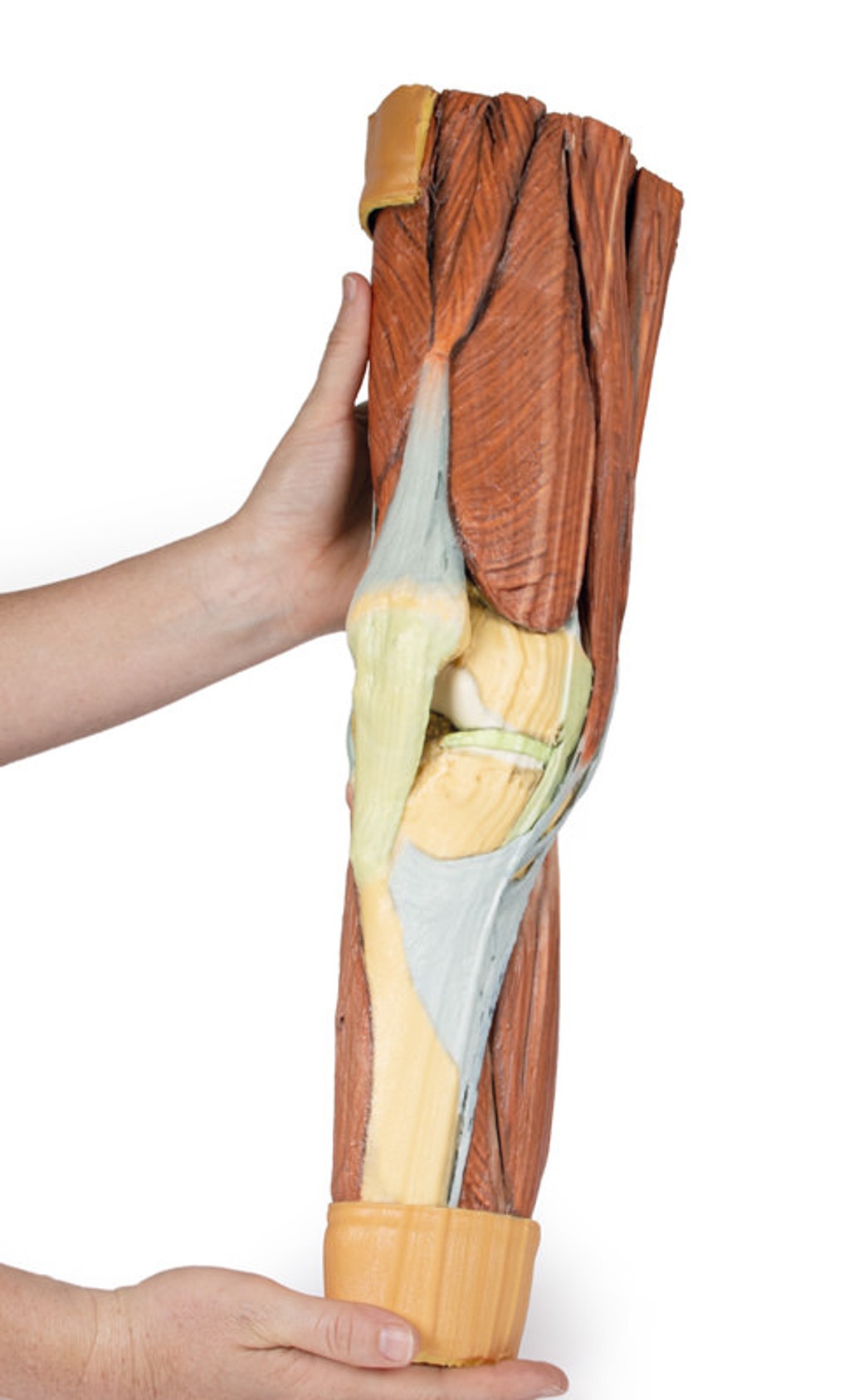 3D Printed Lower Limb Musculature
