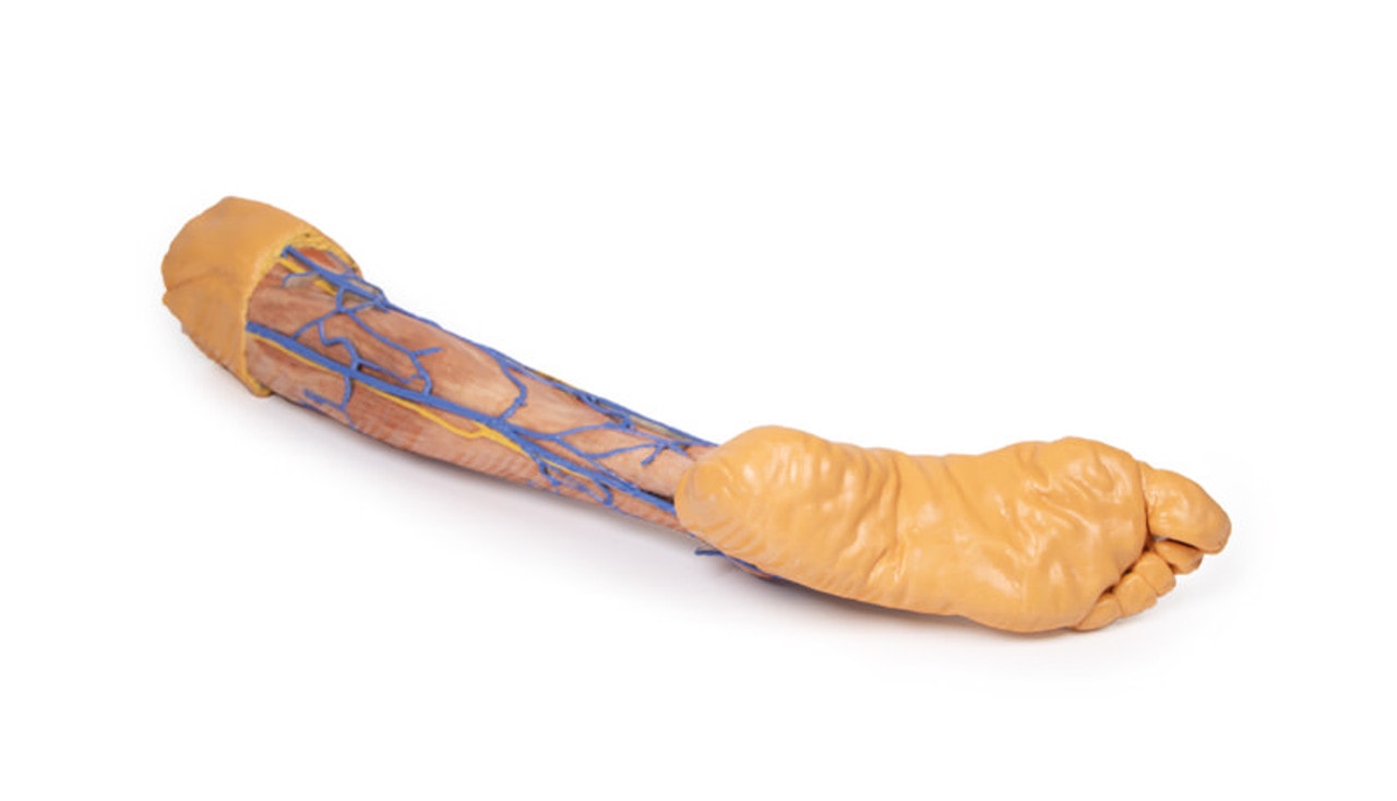 3D Printed Lower Limb Superficial Veins