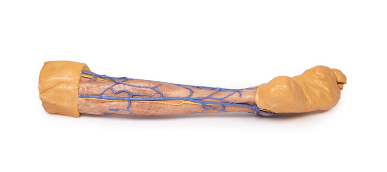 3D Printed Lower Limb Superficial Veins